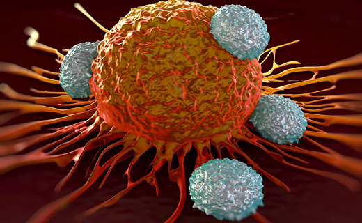 5 نشانه بارز موذی ترین سرطان در بدن