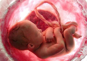 «سقط جنین» ۳۲ برابر بیشتر از کرونا منجر به مرگ شده است!
