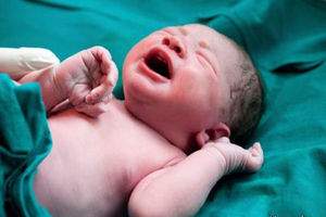 تولد روزانه ۲۰ نوزاد کم شنوا در کشور